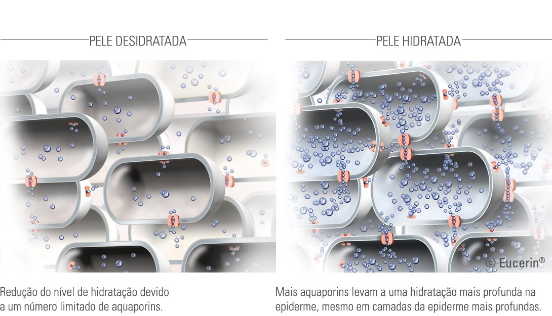 Ilustração de pele hidratada e desidratada.