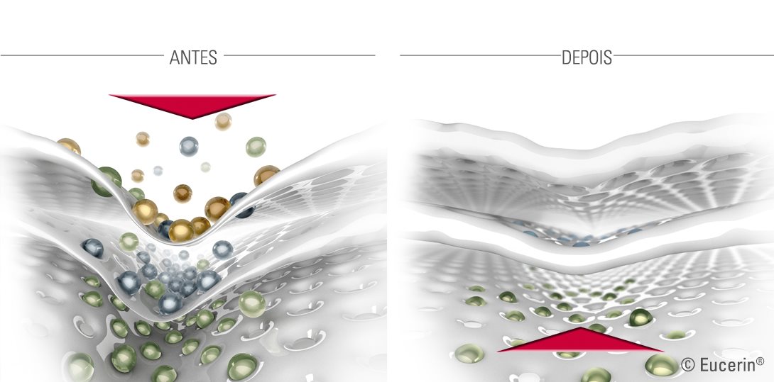Ilustração da pele antes e depois de Eucerin Hyaluron-Filler.