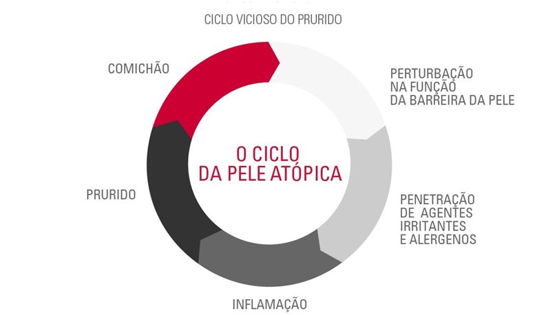 O Ciclo da Pele Atópica (também conhecido como o Ciclo Itch-Scratch)