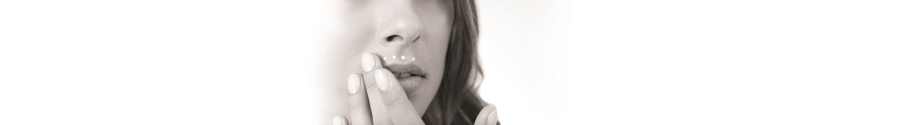 Rosto de mulher com melasma